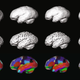 Top: Computer reconstruction of Neanderthal brains. Middle: Typical modern human brains. Bottom: Reconstructed Neanderthal brains with regions highlighted.